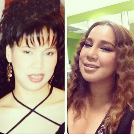 ส้มเช้ง สามช่า ศัลยกรรม