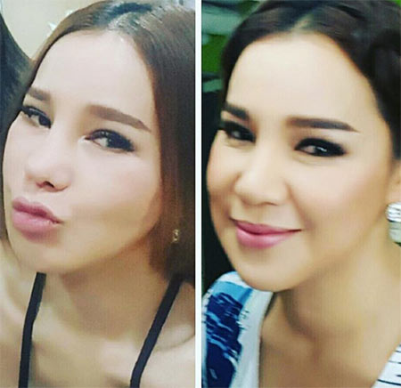 ส้มเช้ง สามช่า ศัลยกรรม