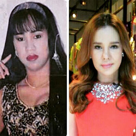 ส้มเช้ง สามช่า ศัลยกรรม