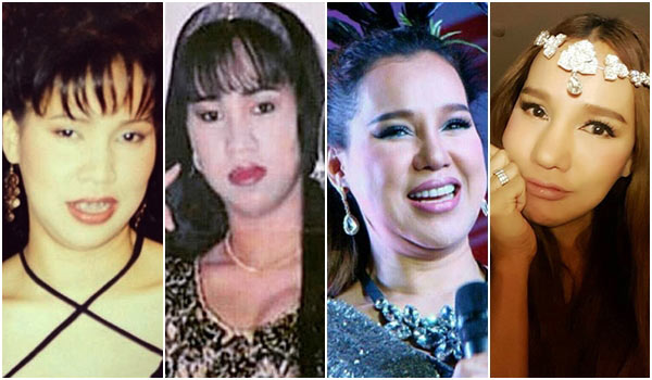 ส้มเช้ง สามช่า ศัลยกรรม