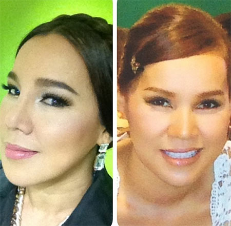 ส้มเช้ง สามช่า ศัลยกรรม