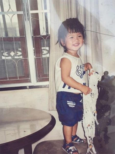 ใบเฟิร์น พิมพ์ชนก ศัลยกรรม