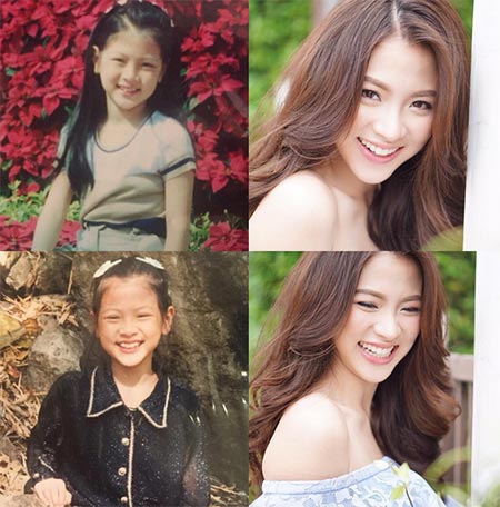 ใบเฟิร์น พิมพ์ชนก ศัลยกรรม