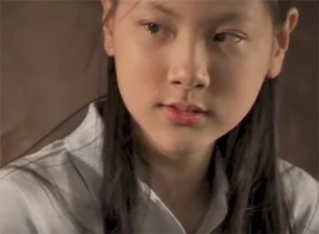 ใบเฟิร์น พิมพ์ชนก ศัลยกรรม