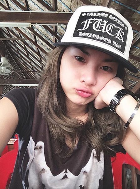 มด ณปภัช ศัลยกรรม