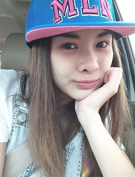 มด ณปภัช ศัลยกรรม