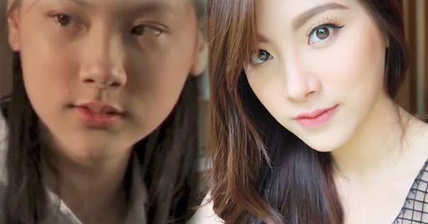 ใบเฟิร์น พิมพ์ชนก ศัลยกรรม