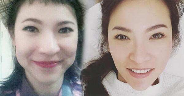 ดีเจต้นหอม ศัลยกรรม