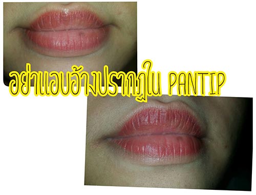 ลบรอยสักคิ้ว