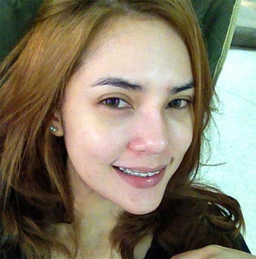 ดาราใส่เหล็กดัดฟัน