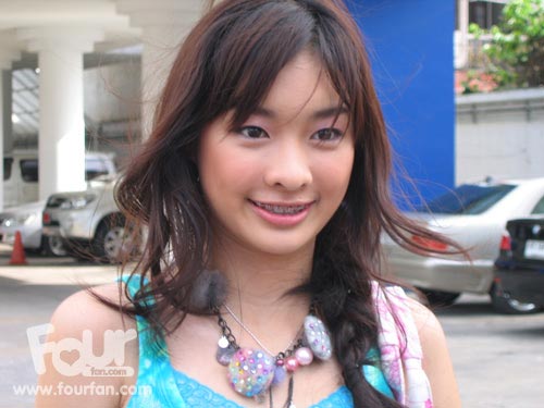 ดาราใส่เหล็กดัดฟัน