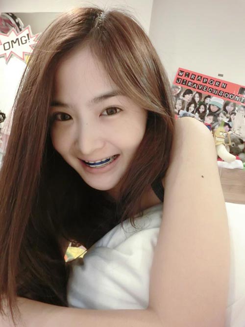 ดาราใส่เหล็กดัดฟัน