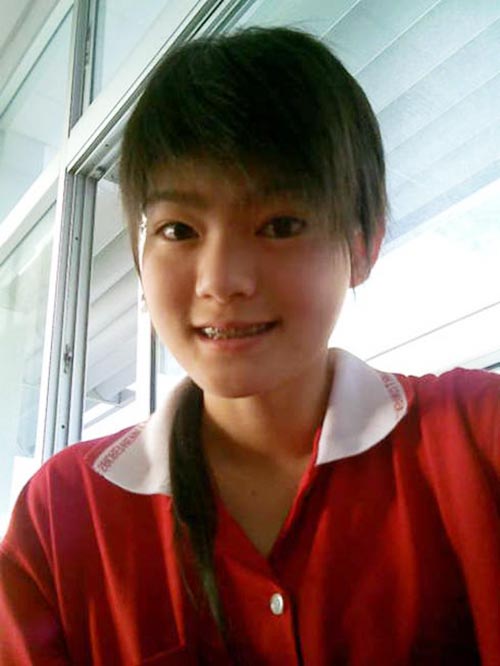 ดาราใส่เหล็กดัดฟัน