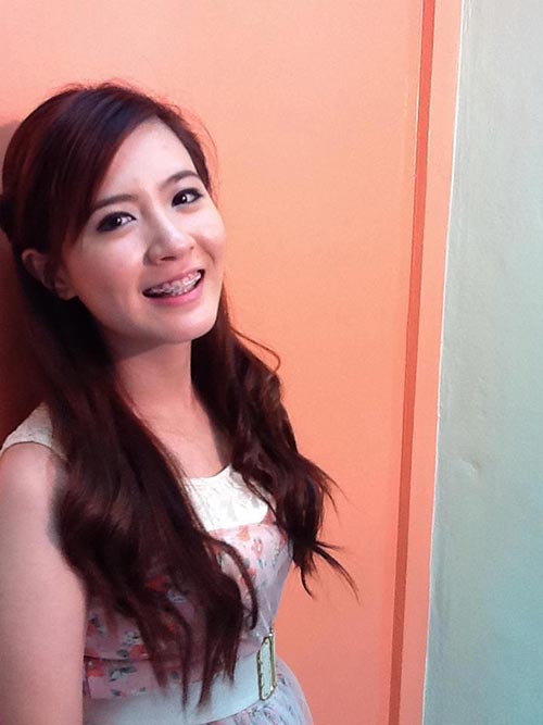 ดาราใส่เหล็กดัดฟัน