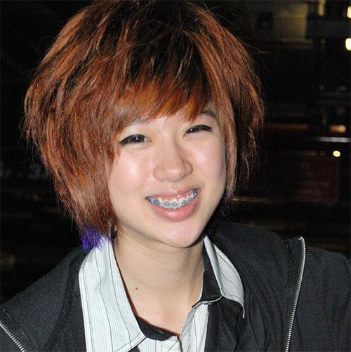 ดาราใส่เหล็กดัดฟัน