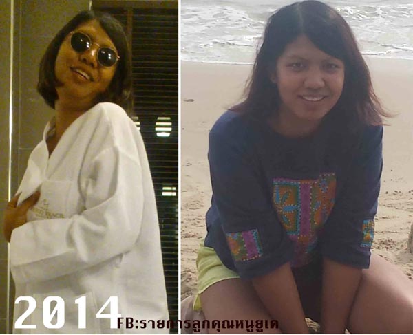 วิธีลดน้ำหนัก