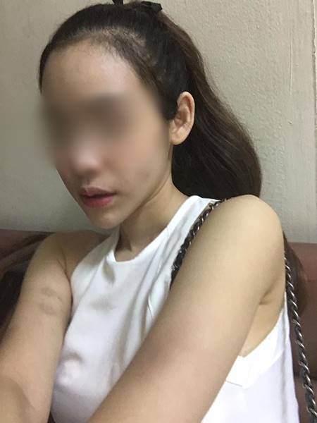 ดาราสังกัด พจน์ อานนท์ ทำร้ายแฟนเก่า