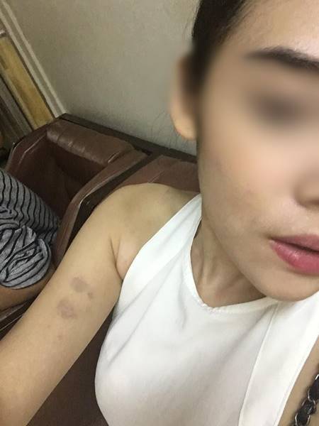 ดาราสังกัด พจน์ อานนท์ ทำร้ายแฟนเก่า