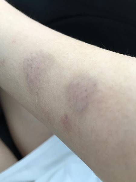 ดาราสังกัด พจน์ อานนท์ ทำร้ายแฟนเก่า