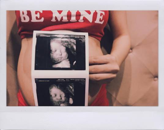 กุ๊บกิ๊บ สุมณทิพย์