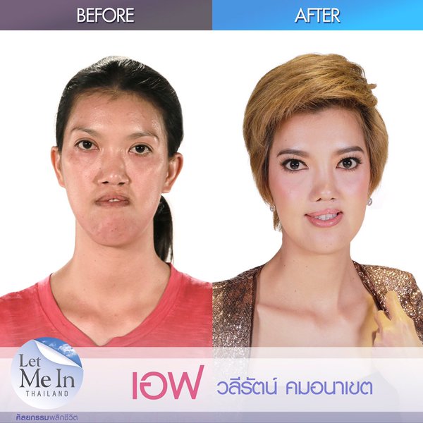 เอฟ วลีรัตน์ Let Me In Thailand