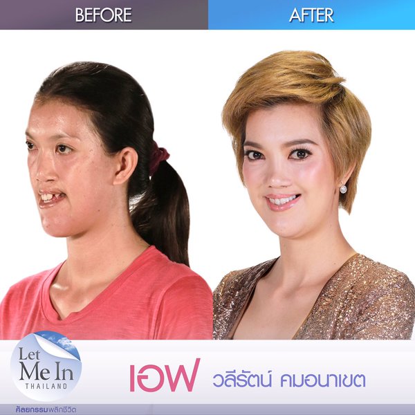 เอฟ วลีรัตน์ Let Me In Thailand