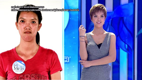 เอฟ วลีรัตน์ Let Me In Thailand