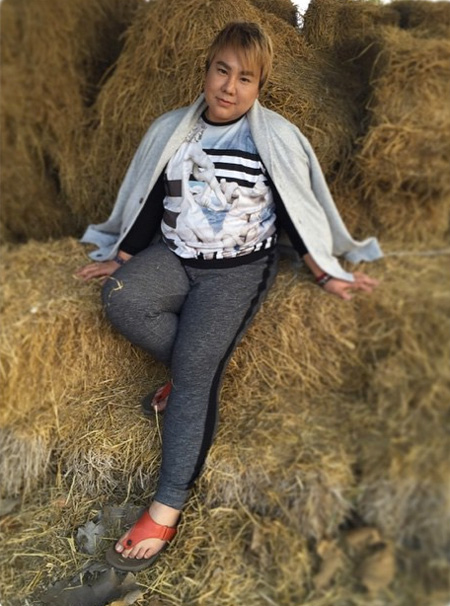 ดีเจบุ๊คโกะ ศัลยกรรม