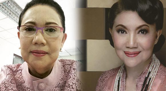 มี๊ พิศมัย วิไลศักดิ์ ศัลยกรรม