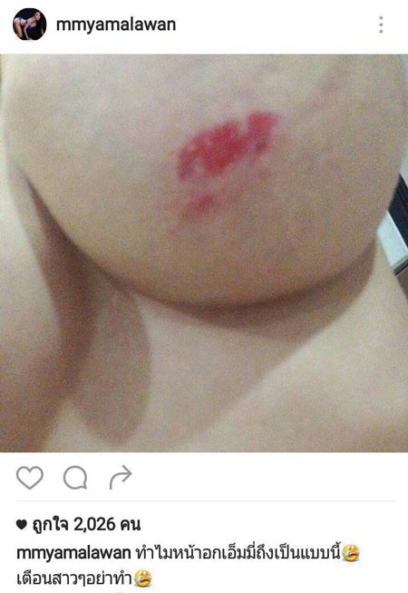 เอมมี่ อมลวรรณ