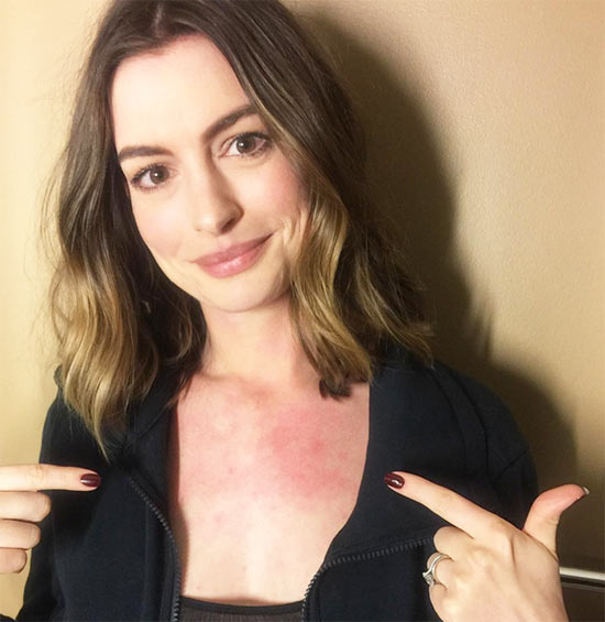 ทรงผมประบ่า