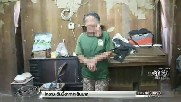 โรคท้าวแสนปม 