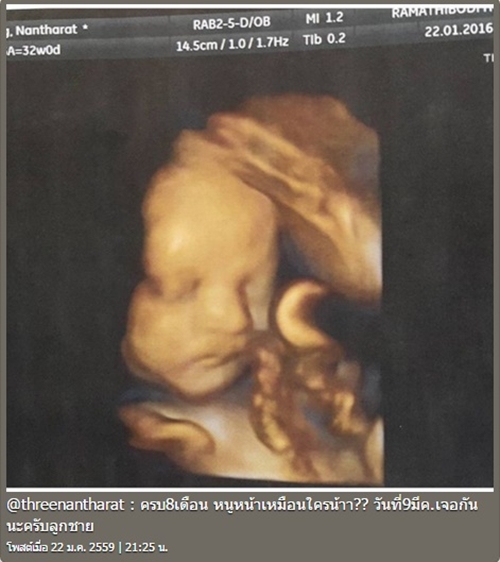 ตรี นันทรัตน์ เชาวราษฎร์