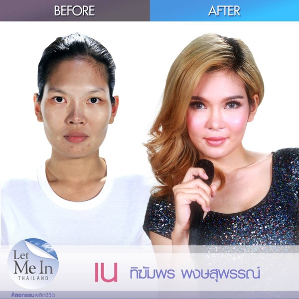 Let Me In Thailand ศัลยกรรมพลิกชีวิต