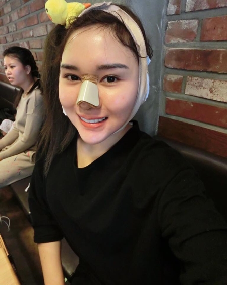  แมลงเมี่ยง