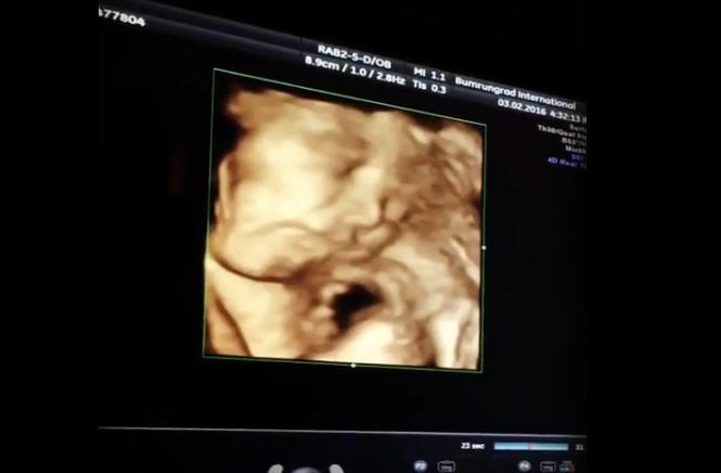 ต่าย ชุติมา