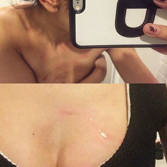  ดาราวัยรุ่นจากซีรีส์ดัง ซ้อมแฟนสาว 