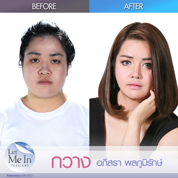 Let Me In Thailand คนที่ 5