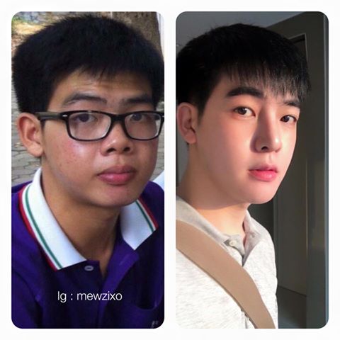 ทำหน้าได้ชาตินี้ ! มิว สุรเดช จากหนุ่มหน้าบ้าน ๆ ศัลยกรรมจนหล่อเว่อร์