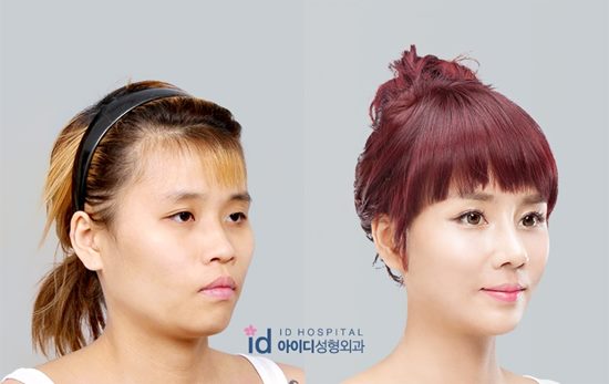 สาวลุคทอมบอย ศัลยกรรมเปลี่ยนชีวิต กลายเป็นสาวหวานสุดฟรุ้งฟริ้ง