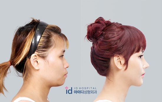 สาวลุคทอมบอย ศัลยกรรมเปลี่ยนชีวิต กลายเป็นสาวหวานสุดฟรุ้งฟริ้ง