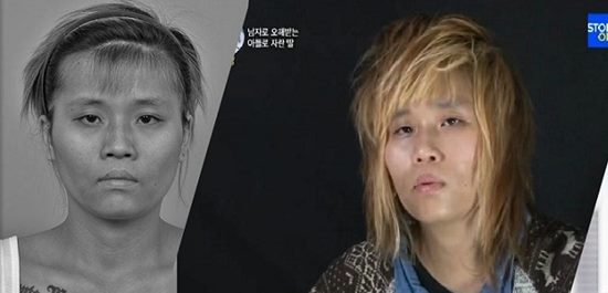 สาวลุคทอมบอย ศัลยกรรมเปลี่ยนชีวิต กลายเป็นสาวหวานสุดฟรุ้งฟริ้ง