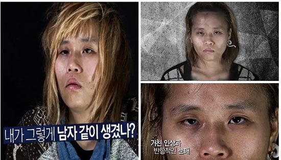 สาวลุคทอมบอย ศัลยกรรมเปลี่ยนชีวิต กลายเป็นสาวหวานสุดฟรุ้งฟริ้ง