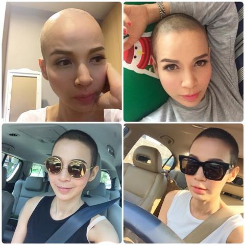 เวย์ NBT ผู้ประกาศข่าวสาวผู้ไม่ย่อท้อ ขอต่อสู้กับมะเร็ง แม้ผมร่วงทั้งหัว