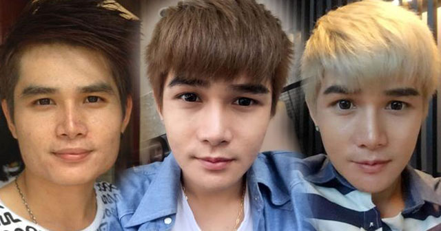 ผู้ชายทําศัลยกรรม