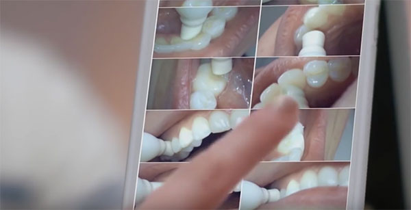 แปรงสีฟันติดกล้อง