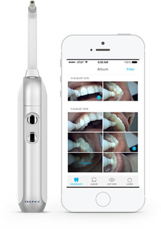 แปรงสีฟันติดกล้อง