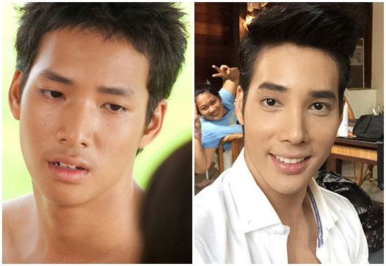 อ้วน เด่นคุณ 