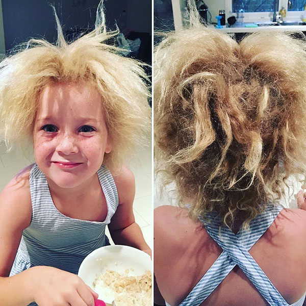 หนูน้อย 7 ขวบ ป่วยโรคแปลก ผมหวีไม่ได้ แต่กลายเป็นเก๋ไปอีกแบบ