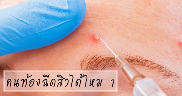 คนท้องฉีดสิวได้ไหม